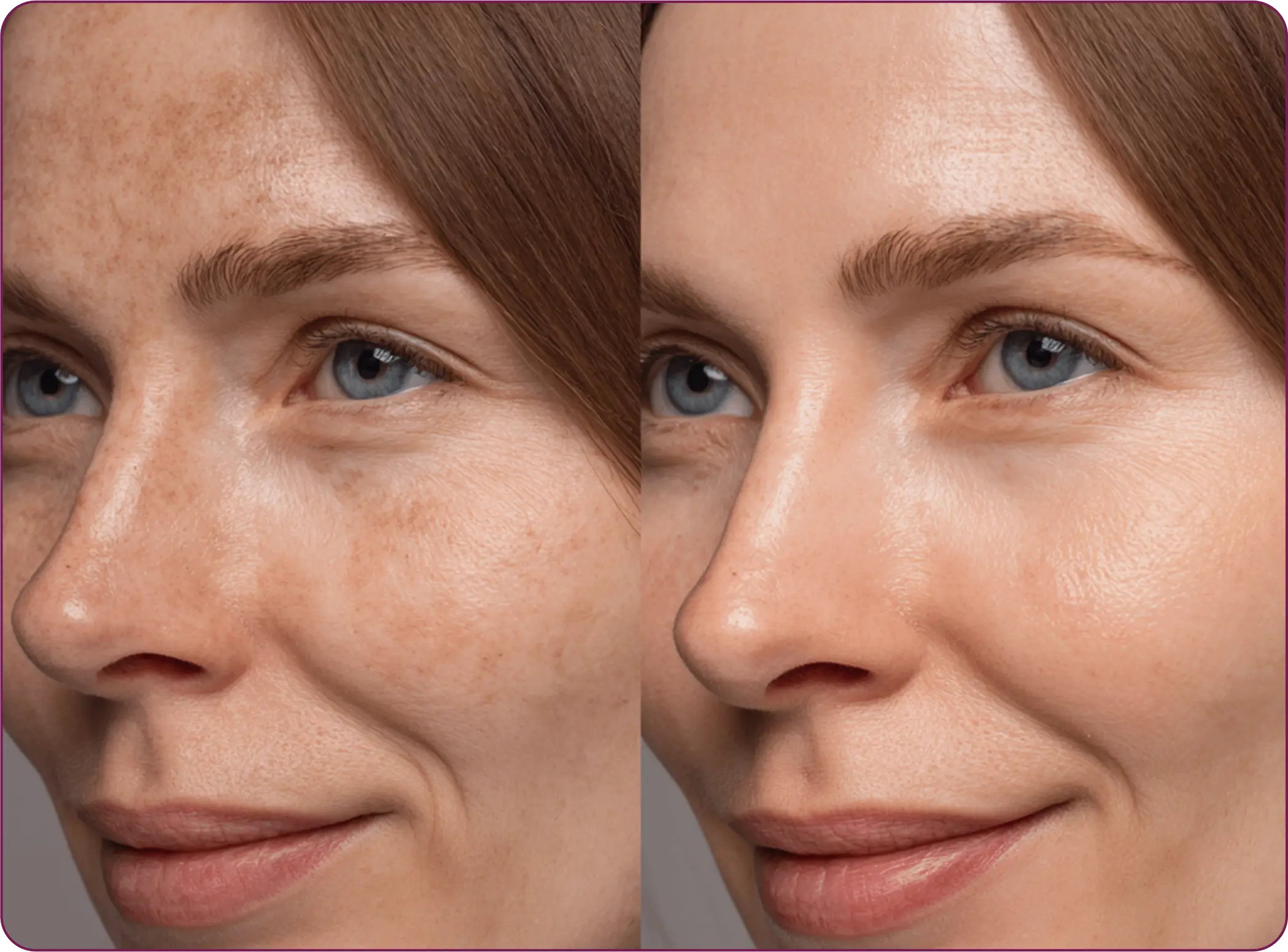 before and after skin comparison showing improved texture brightness and reduced spots natural skincare results